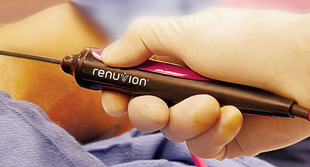 Renuvion®