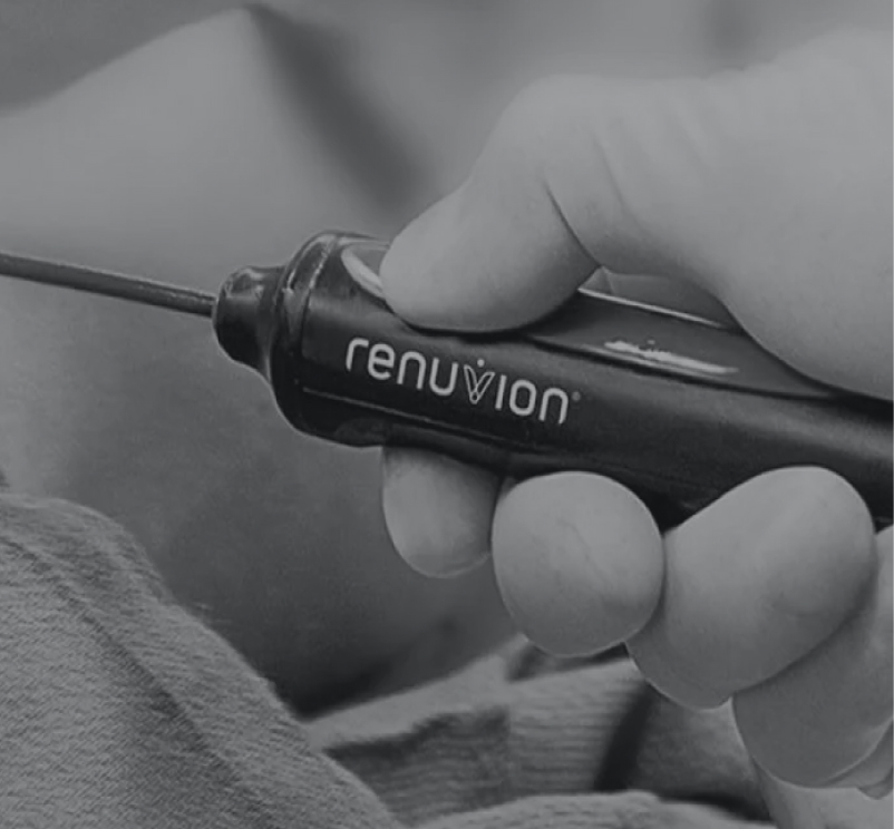 Renuvion®