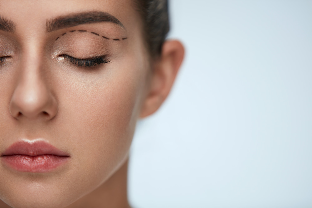 Por que fazer a cirurgia de pálpebras?