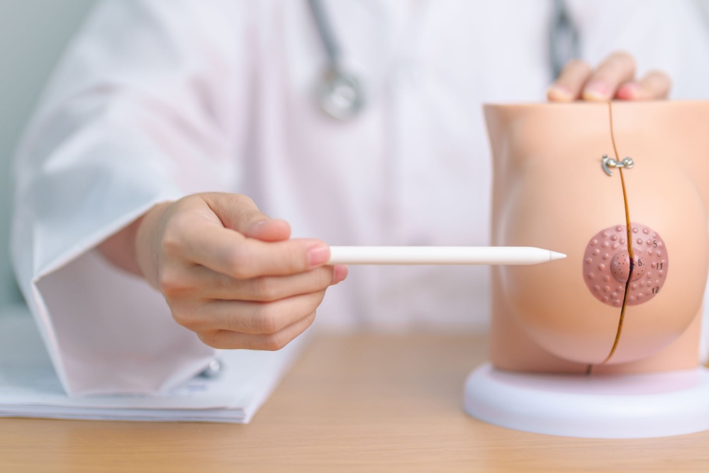 Mastopexia periareolar: o que é e como funciona?
