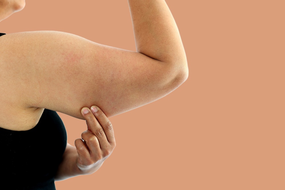 Quais os benefícios da braquioplastia?