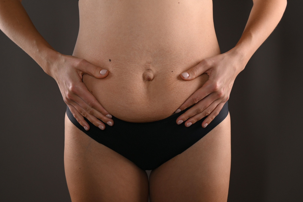 Qual o preço da abdominoplastia em 2024? - Dr. Edgar Lopez